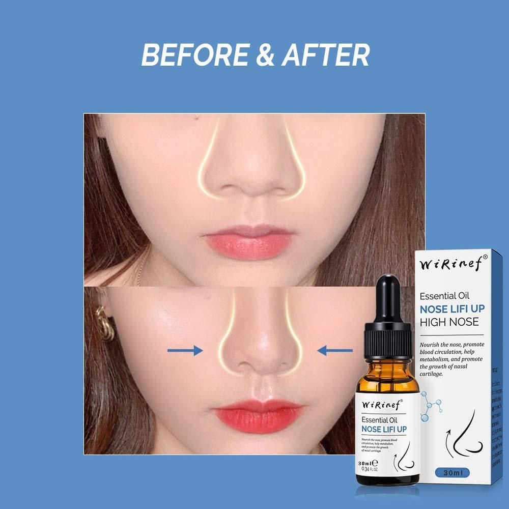 Lifting Essential Oil for Nose Shape 30ml